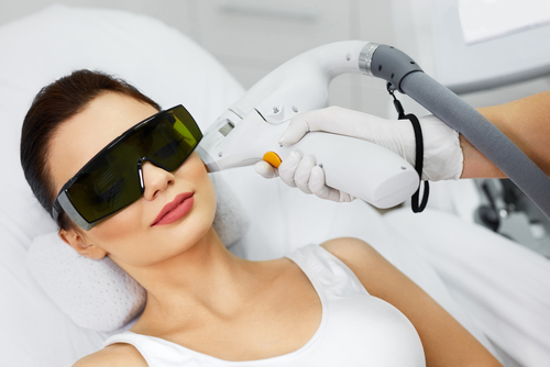 laser_treatment_for_brown_spots